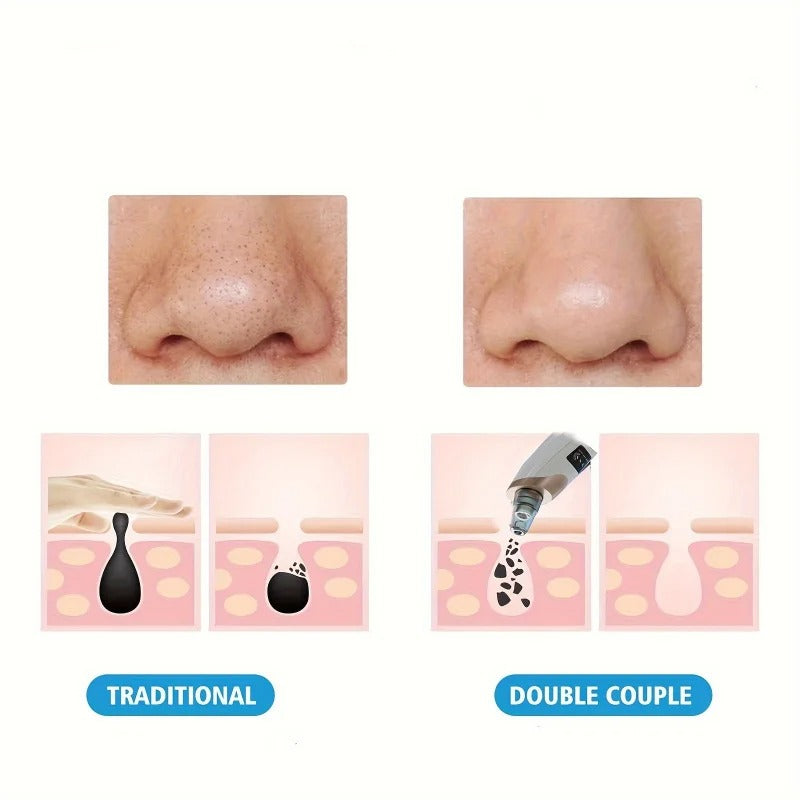 Rechargeable 5-in-1 Blackhead Remover & Pore Cleaner