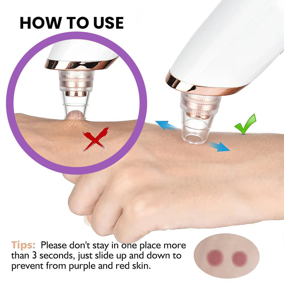 Rechargeable 5-in-1 Blackhead Remover & Pore Cleaner