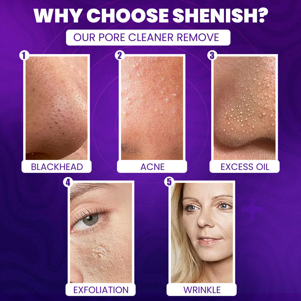 Rechargeable 5-in-1 Blackhead Remover & Pore Cleaner